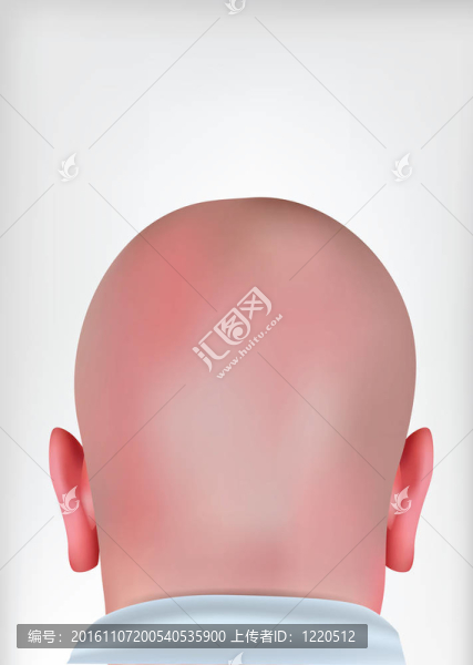 現(xiàn)實(shí)的禿頭