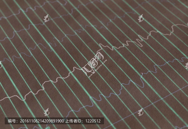 在encephalogramme,EEG腦電波