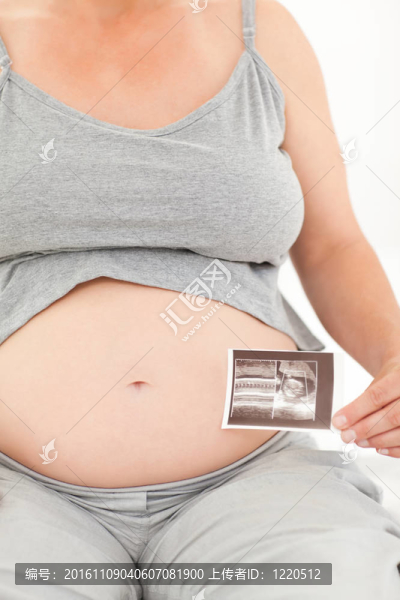 孕婦X射線