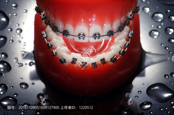 帶支撐義齒；水滴背景