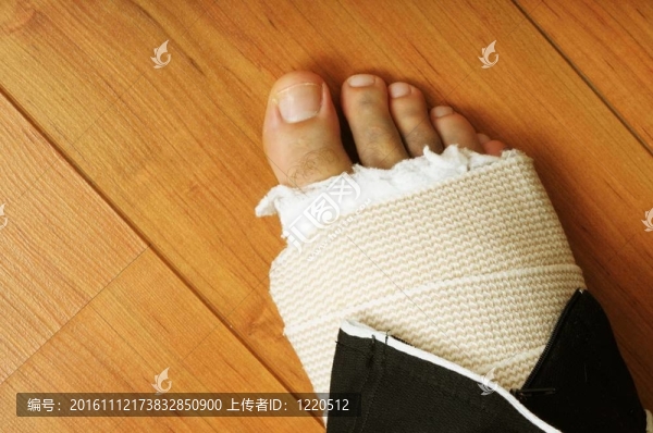 男性用石膏斷腳的特寫圖像