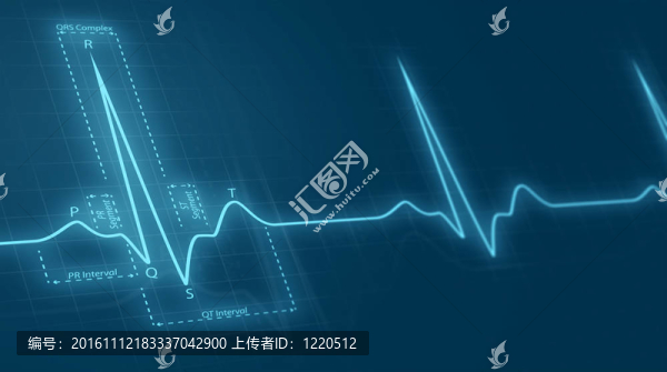 心電圖