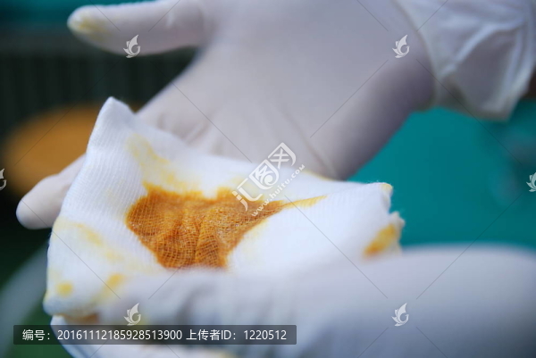 手術(shù)；手術(shù)；工作；生病；生??；手外科；