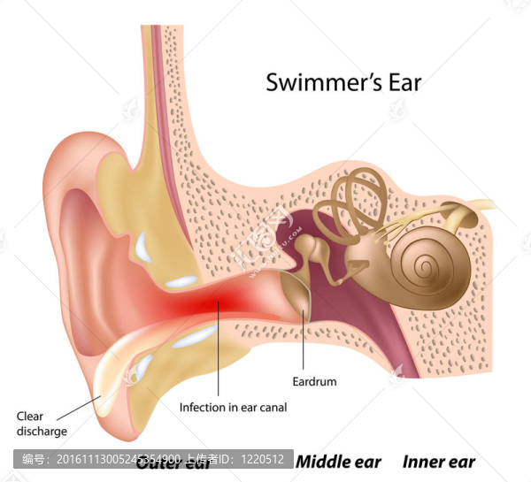 游泳者的耳朵；中