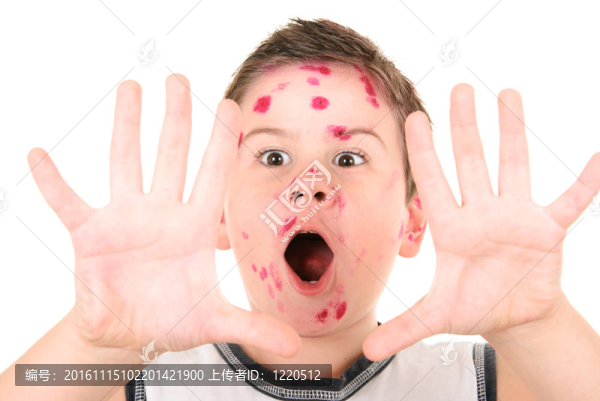 生病的水痘男孩
