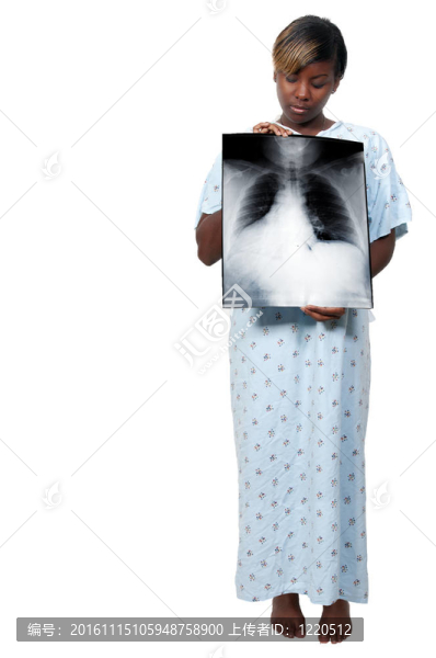 黑女病人
