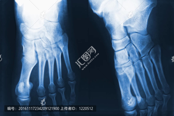 腳線