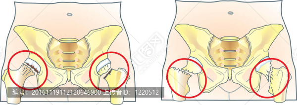 大腿骨