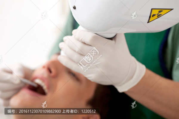 牙科X射線細(xì)節(jié)