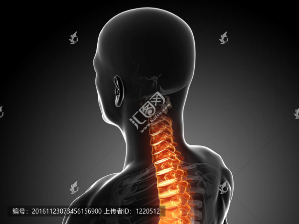 背痛的插圖
