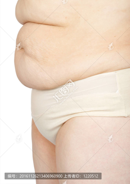 有一肚子的女人蜂窩織炎