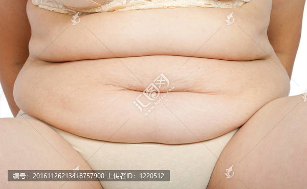 有一肚子的女人蜂窩織炎