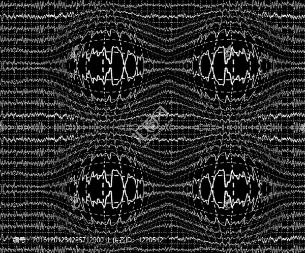 在encephalogramme,EEG腦電波