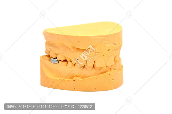 牙模具