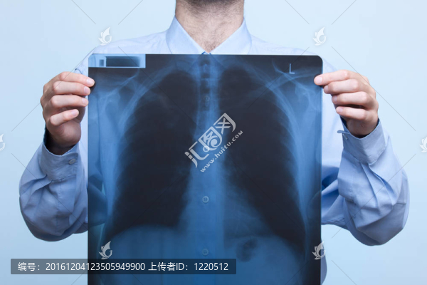 胸部X光
