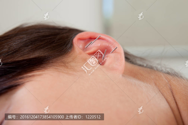 耳針的細(xì)節(jié)