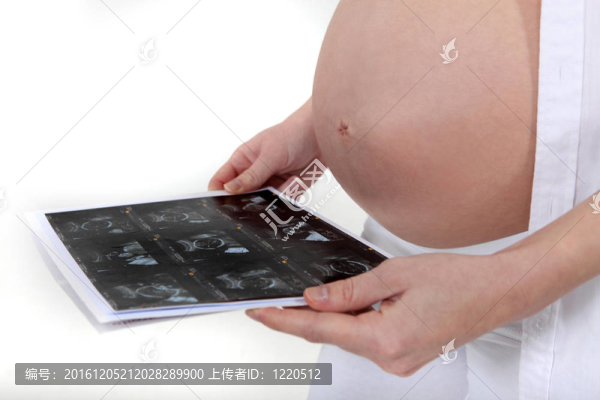 一個懷孕的女人看著她回波描記術(shù)。
