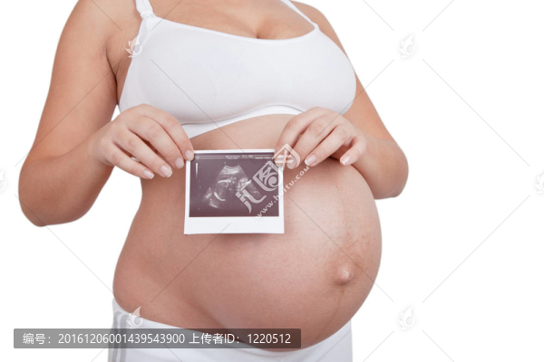 孕婦手持超聲檢查圖片