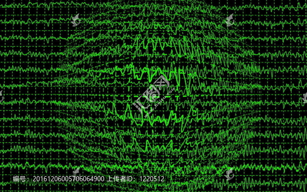 腦電波encephalogramme腦電圖