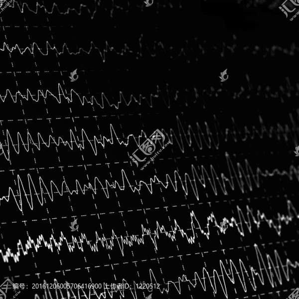 腦電波encephalogramme腦電圖