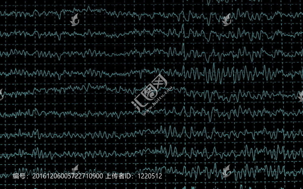 在encephalogramme腦波