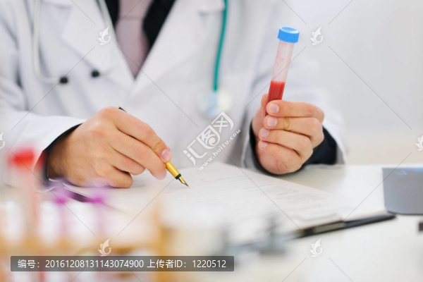 特寫在醫(yī)生手中持有的血液樣本并做筆記