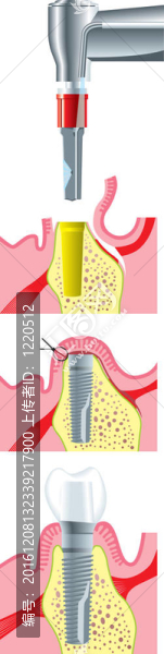 牙科手術(shù)