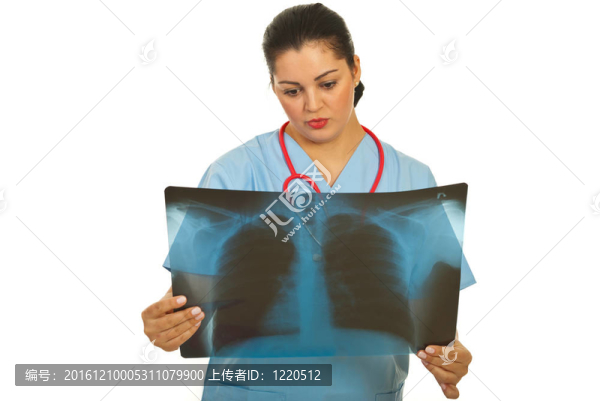 女性的X射線放射