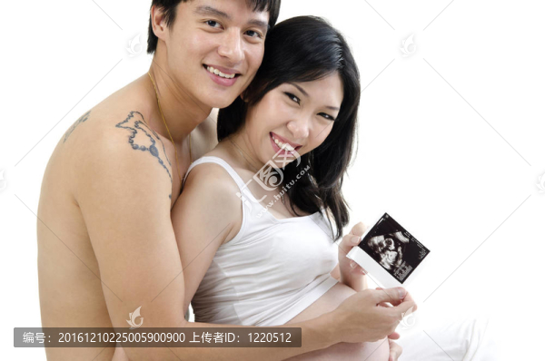 超聲圖像
