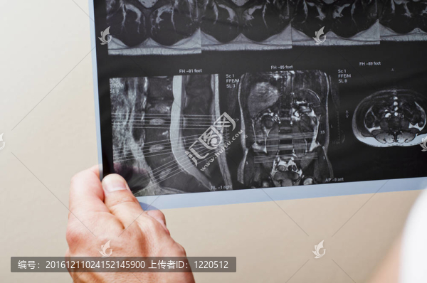 MRI