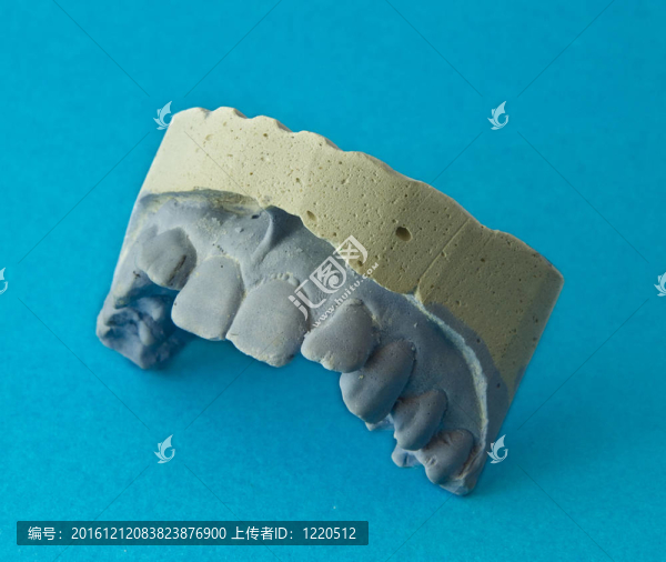 牙齒石膏模型