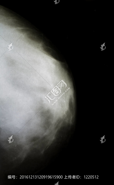 女人的乳房X射線