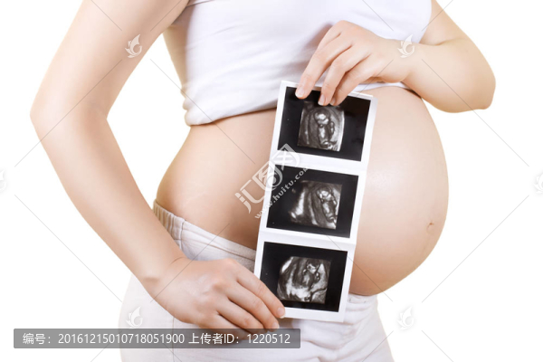 孕婦超聲圖像