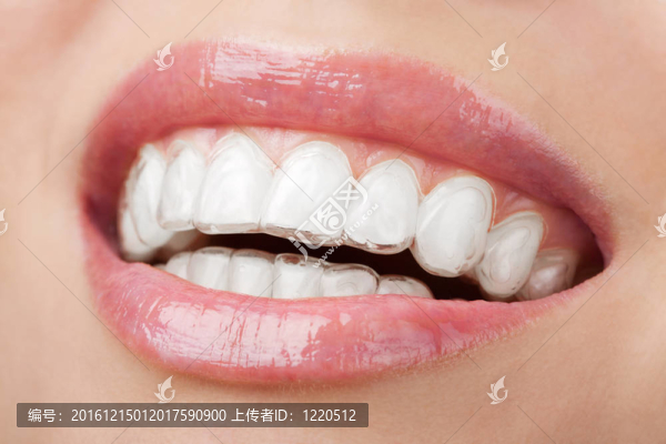 帶美白托盤的牙齒
