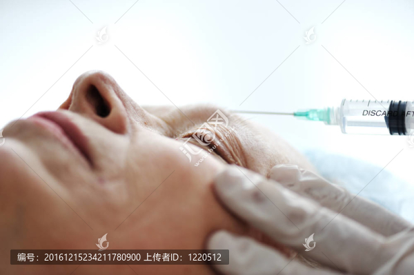 肉毒桿菌毒素注射在面部皮膚