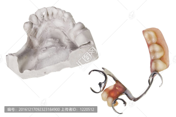 石膏牙和假牙