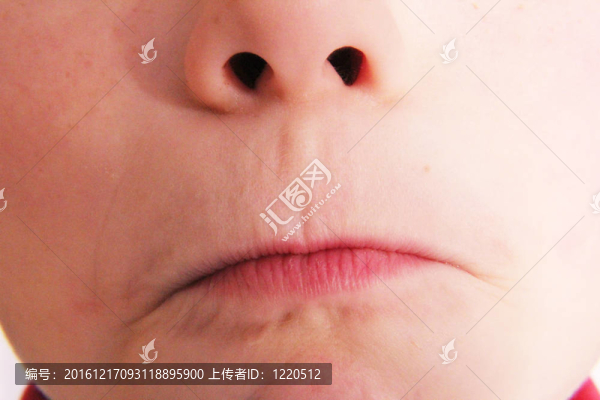 口