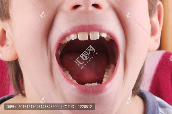 口