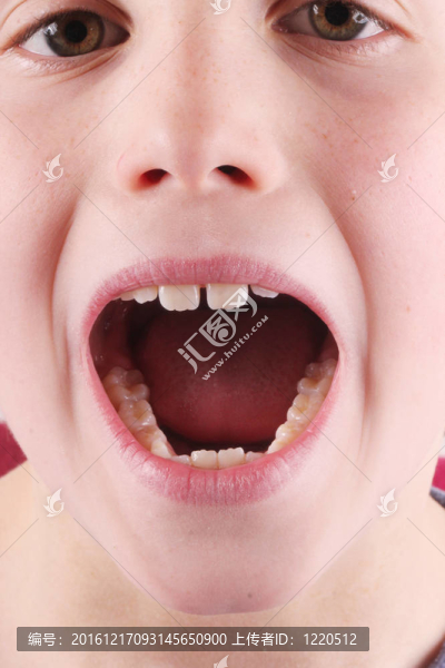 口