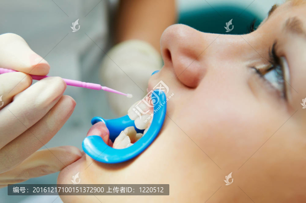 牙保護(hù)牙法