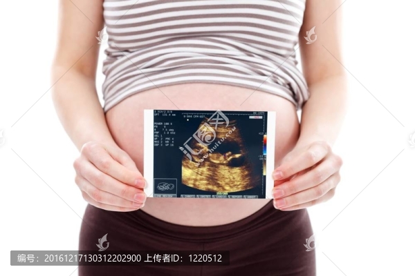 孕婦超聲掃描