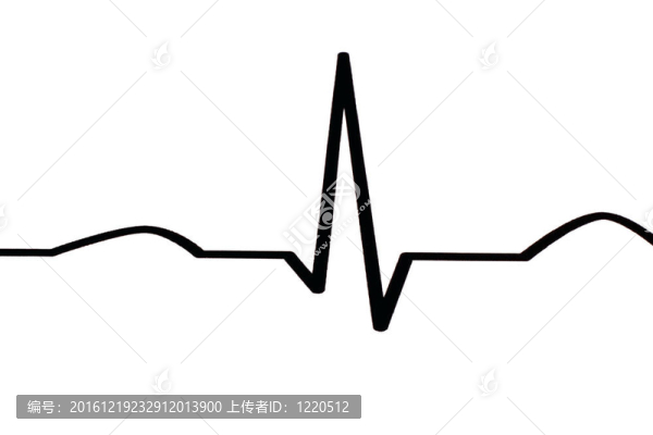 心電圖