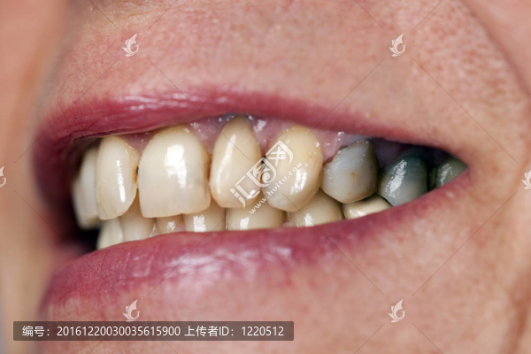 一個(gè)該對(duì)女性牙齒