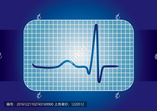 心電曲線