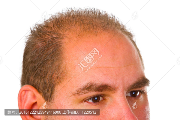 有頭發(fā)問題的年輕人