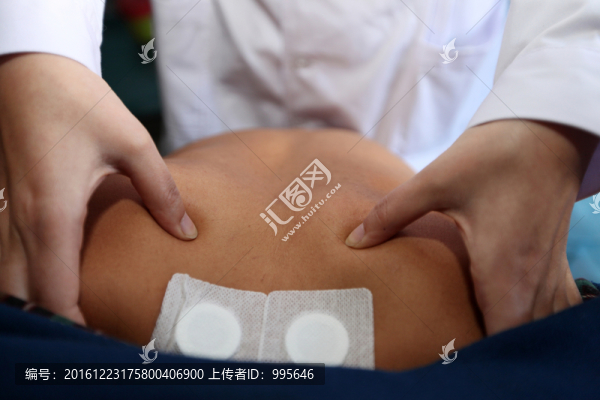 中醫(yī)貼敷