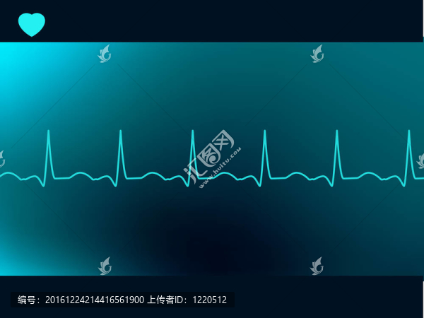 摘要心跳的心電圖。EPS,8