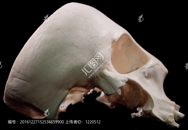 人類頭骨