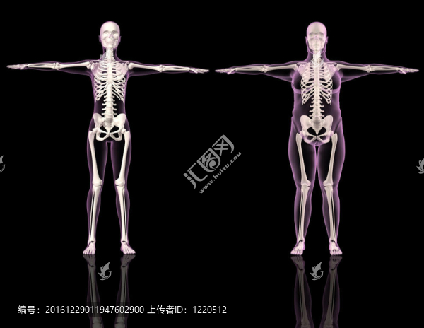 醫(yī)療女性骨骼苗條和超重