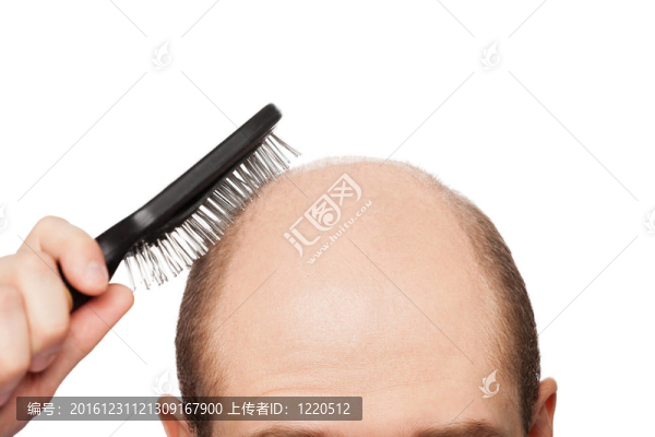 禿頭的男人的頭